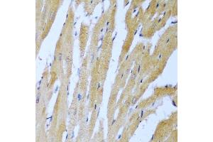 Immunohistochemistry (Paraffin-embedded Sections) (IHC (p)) image for anti-Insulin-Like Growth Factor 2 mRNA Binding Protein 3 (IGF2BP3) (AA 1-200) antibody (ABIN3016599)