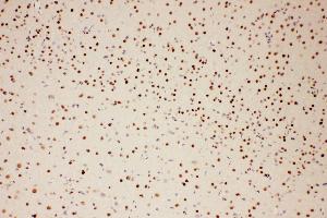 Immunohistochemistry (IHC) image for anti-Protein Inhibitor of Activated STAT, 1 (PIAS1) (AA 636-651), (C-Term) antibody (ABIN3044474)