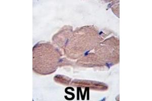 Immunohistochemistry (IHC) image for anti-Myostatin (MSTN) antibody (ABIN2916193)