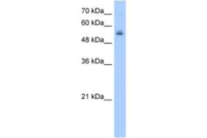 Western Blotting (WB) image for anti-UDP Glycosyltransferase 3 Family, Polypeptide A2 (UGT3A2) antibody (ABIN2463263)