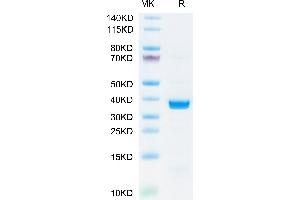 SARS-COV-2 PLpro on Tris-Bis PAGE under reduced condition. (SARS-CoV NSP3 Protein (AA 1564-1880) (His tag))