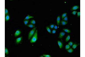 Immunofluorescent analysis of HepG2 cells using ABIN7171676 at dilution of 1:100 and Alexa Fluor 488-congugated AffiniPure Goat Anti-Rabbit IgG(H+L) (TCTN3 抗体  (AA 348-472))