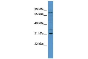 WB Suggested Anti-Fbxo34 Antibody Titration: 0. (FBXO34 抗体  (N-Term))