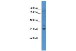 WB Suggested Anti-Fbxo34 Antibody Titration: 0.