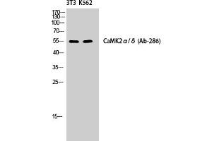 Western Blotting (WB) image for anti-CaMKIIalpha/delta (Thr286) antibody (ABIN5960662) (CaMKIIalpha/delta 抗体  (Thr286))