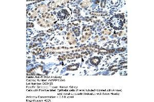 Human kidney (Serotonin Receptor 3A 抗体  (N-Term))