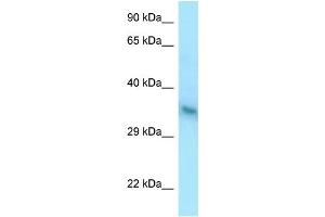 WB Suggested Anti-YIPF1 Antibody Titration: 1. (YIPF1 抗体  (C-Term))