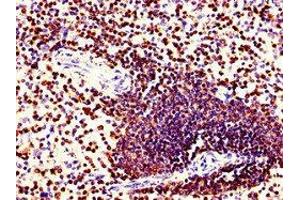 Immunohistochemistry of paraffin-embedded human spleen tissue using ABIN7148593 at dilution of 1:100 (Coronin 1a 抗体  (AA 363-432))