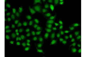 Immunofluorescence analysis of A549 cell using SULT2B1 antibody. (SULT2B1 抗体)