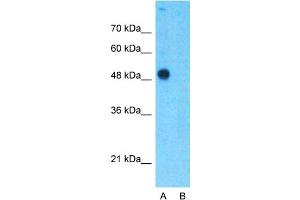 Host:  Rabbit  Target Name:  TEAD4  Sample Type:  293T  Lane A:  Primary Antibody  Lane B:  Primary Antibody + Blocking Peptide  Primary Antibody Concentration:  1ug/ml  Peptide Concentration:  5ug/ml  Lysate Quantity:  25ug/lane/lane  Gel Concentration:  0. (TEAD4 抗体  (C-Term))