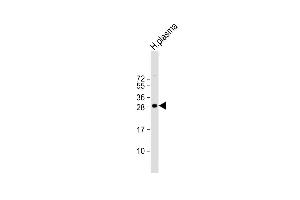 Anti-C1QB Antibody (N-term) at 1:1000 dilution + human plasma lysate Lysates/proteins at 20 μg per lane. (C1QB 抗体  (N-Term))