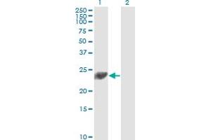 Western Blotting (WB) image for anti-Proteasome (Prosome, Macropain) 26S Subunit, Non-ATPase, 10 (PSMD10) (AA 127-226) antibody (ABIN562495)