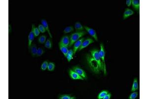 Immunofluorescent analysis of HepG2 cells using ABIN7163920 at dilution of 1:100 and Alexa Fluor 488-congugated AffiniPure Goat Anti-Rabbit IgG(H+L) (KCNK13 抗体  (AA 292-408))