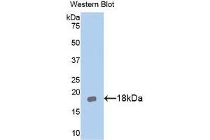 Western blot analysis of the recombinant protein. (IL18RAP 抗体  (AA 396-548))