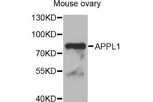 Western Blotting (WB) image for anti-Adaptor Protein, phosphotyrosine Interaction, PH Domain and Leucine Zipper Containing 1 (APPL1) (AA 1-210) antibody (ABIN6220712) (APPL1 抗体  (AA 1-210))