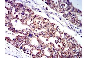 Immunohistochemistry (IHC) image for anti-Interleukin 9 Receptor (IL9R) (AA 41-270) antibody (ABIN5611174)
