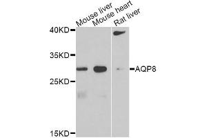 Western blot analysis of extracts of various cell lines, using AQP8 antibody. (Aquaporin 8 抗体)