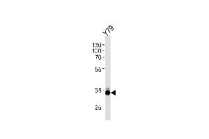 OTX2 Antibody (C-term) (ABIN1881611 and ABIN2845106) western blot analysis in Y79 cell line lysates (35 μg/lane). (OTX2 抗体  (C-Term))
