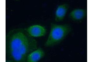 Immunohistochemistry (IHC) image for anti-serpin Peptidase Inhibitor, Clade A (Alpha-1 Antiproteinase, Antitrypsin), Member 10 (SERPINA10) (AA 278-425) antibody (ABIN7438085)