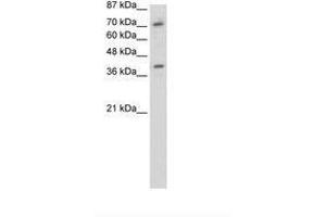 Image no. 1 for anti-Zinc Finger Protein 282 (ZNF282) (C-Term) antibody (ABIN202865) (ZNF282 抗体  (C-Term))