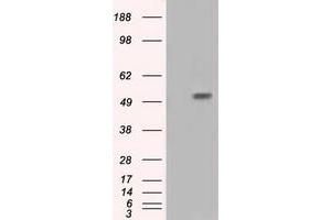 Western Blotting (WB) image for anti-Intraflagellar Transport 57 Homolog (IFT57) antibody (ABIN1498811) (IFT57 抗体)
