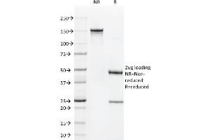 SDS-PAGE Analysis Purified CD1a Mouse Monoclonal Antibody (O10). (CD1a 抗体)