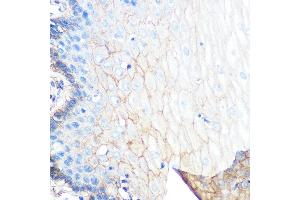 Immunohistochemistry of paraffin-embedded human esophageal using S100 Rabbit mAb (ABIN7270122) at dilution of 1:100 (40x lens). (S100A10 抗体)