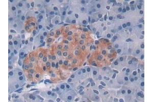 Immunohistochemistry (IHC) image for anti-Methionine Adenosyltransferase II, alpha (MAT2A) (AA 176-395) antibody (ABIN7436291)