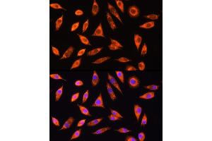 Immunofluorescence analysis of L929 cells using GALNS Rabbit pAb (ABIN6131691, ABIN6140937, ABIN6140938 and ABIN6221120) at dilution of 1:100 (40x lens). (GALNS 抗体  (AA 353-522))