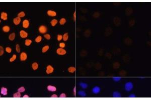 Immunofluorescence analysis of HeLa cells using Acetyl-Histone H3-K4 Polyclonal Antibody at dilution of 1:100.