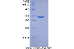 SDS-PAGE analysis of Mouse PIKFYVE Protein.