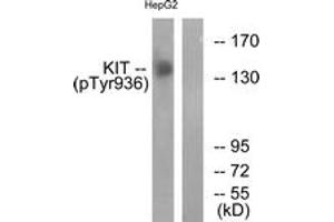 Western blot analysis of extracts from HepG2 cells treated with EGF 200ng/ml 30', using KIT (Phospho-Tyr936) Antibody.
