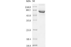 (Tris-Glycine gel) Discontinuous SDS-PAGE (reduced) with 5 % enrichment gel and 15 % separation gel.
