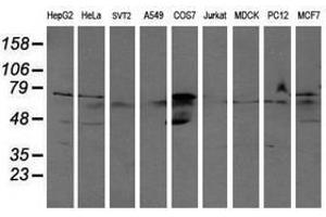 Image no. 2 for anti-Aldehyde Dehydrogenase 3 Family, Member A2 (ALDH3A2) antibody (ABIN1496594) (ALDH3A2 抗体)