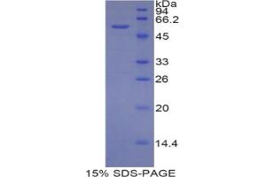 SDS-PAGE analysis of Mouse CUZD1 Protein. (CUZD1 蛋白)
