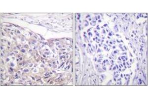Immunohistochemistry (IHC) image for anti-Ribosomal Protein S6 Kinase, 90kDa, Polypeptide 3 (RPS6KA3) (AA 539-588), (pThr573) antibody (ABIN1531364)