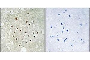 Immunohistochemistry analysis of paraffin-embedded human brain tissue, using RPS19BP1 Antibody. (RPS19BP1 抗体  (AA 71-120))