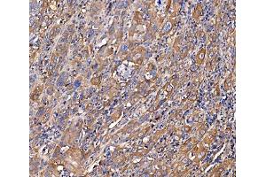 IHC analysis of SCRN1 using anti-SCRN1 antibody (ABIN7602923). (Secernin 1 抗体  (C-Term))