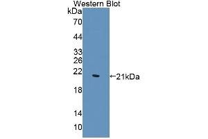 Western blot analysis of the recombinant protein. (WTAP 抗体  (AA 1-150))