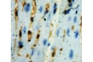 Used in DAB staining on fromalin fixed paraffin-embedded Heart tissue (GLRX3 抗体  (AA 10-117))