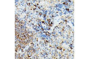 Immunohistochemistry (IHC) image for anti-Cylindromatosis (Turban Tumor Syndrome) (CYLD) (AA 654-953) antibody (ABIN1679467)