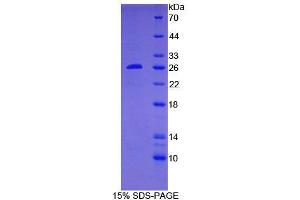 SDS-PAGE analysis of Human BCL2 Protein. (Bcl-2 蛋白)