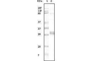 Western blot analysis using NPT mouse mAb against truncated NPT recombinant protein. (NPT 抗体)