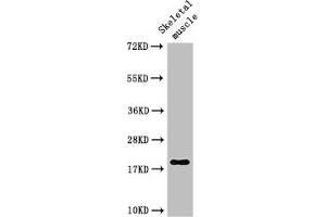 Western Blot Positive WB detected in: Rat skeletal muscle tissue All lanes: TNNC1 antibody at 3 μg/mL Secondary Goat polyclonal to rabbit IgG at 1/50000 dilution Predicted band size: 19 kDa Observed band size: 19 kDa (TNNC1 抗体  (AA 11-149))