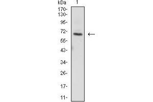 Western Blotting (WB) image for anti-zeta-Chain (TCR) Associated Protein Kinase 70kDa (ZAP70) (AA 169-390) antibody (ABIN7193547)