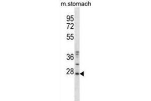 Western Blotting (WB) image for anti-TP53 Regulating Kinase (TP53RK) antibody (ABIN2997879) (TP53RK 抗体)