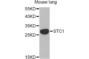 Western blot analysis of extracts of mouse lung, using STC1 Antibody. (Stanniocalcin 1 抗体)