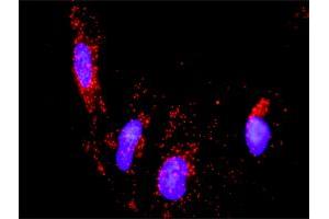 Proximity Ligation Assay (PLA) image for anti-PTK2B Protein tyrosine Kinase 2 beta (PTK2B) (AA 1-1009) antibody (ABIN515514)