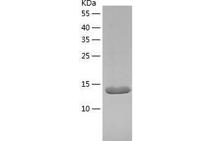 Myoglobin Protein (MB) (AA 2-154) (His tag)