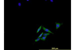 Immunofluorescence of monoclonal antibody to ENG on HeLa cell . (Endoglin 抗体  (AA 27-658))